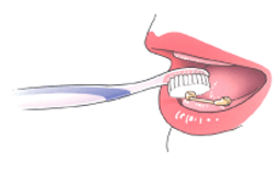 mondhygiene-implantaten